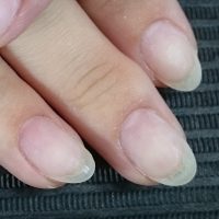 深爪　噛み爪　軽度　中度　改善　矯正　施術　ネイル　サロン