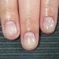 深爪　噛み爪　軽度　中度　改善　矯正　施術　ネイル　サロン